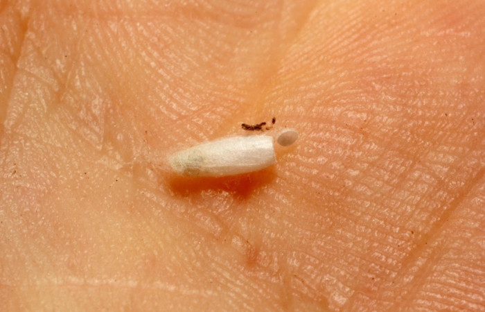 Figura 19. Parasito <i>Apanteles</i> Janzen93 (Braconidae), ataca la especie Pococera sabbasaDHJ04 (Pyralidae). Área de Conservación Guanacaste, Sector Santa Rosa. 13-SRNP-19844-DHJ804570.jpg.