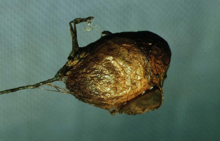 Fig.19 Capullos de parásitos Cotesia Whitfield24 de la familia Ichneumonidae (avispas) en larva <i>Archaeoprepona centralis</i>, (Nymphalidae), se alimenta  <i>Rourea glabra</i>, (Connaraceae). Voucher: 87-SRNP-1398-DHJ10442.jpg.