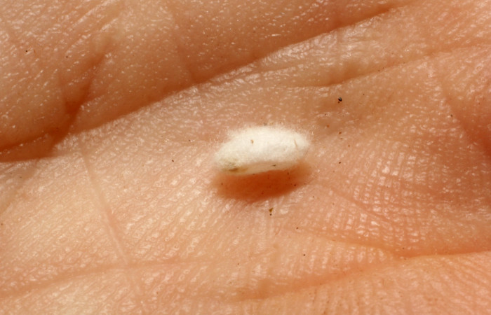 Figura 25. Detalle de capullo <i>Eois</i> Janzen04 (Geometridae). (11-SRNP-70880-DHJ804097).